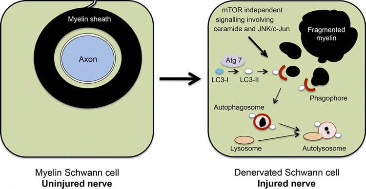 This image shows the proposed role of myelinophagy in a Schwann cell after nerve injury and axon degeneration.