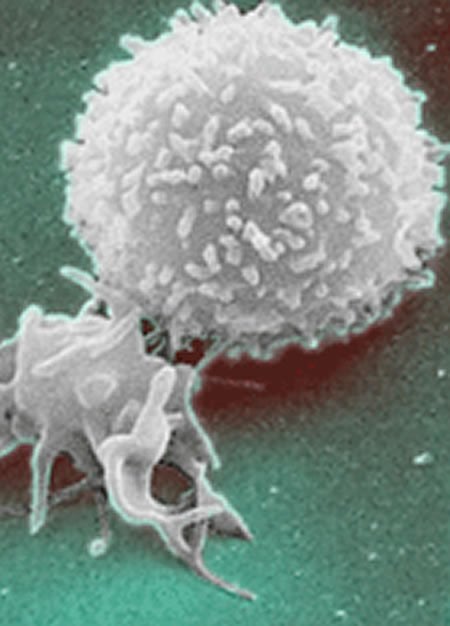 This image shows a white blood cell.