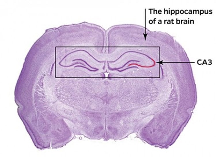 This image shows a hippocampal brain slice.