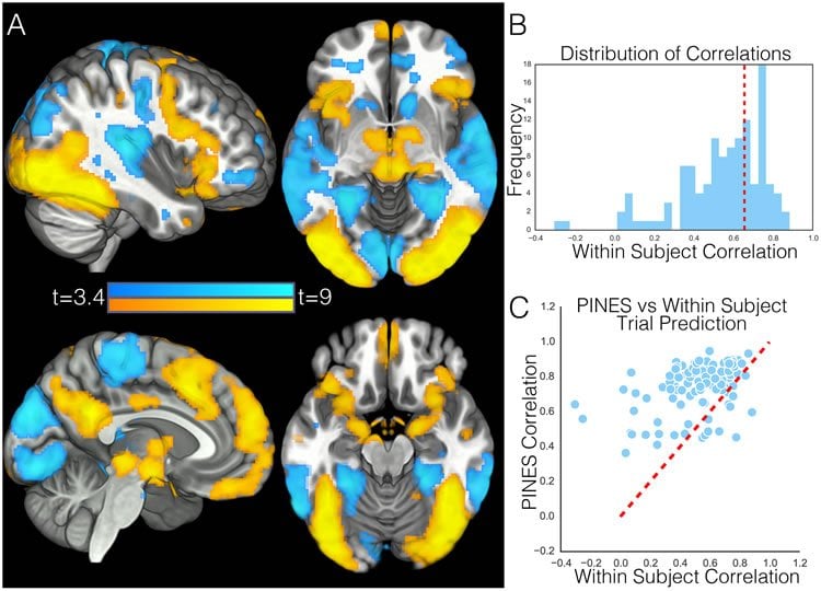 This image shows four brain scans. The caption best describes the image.