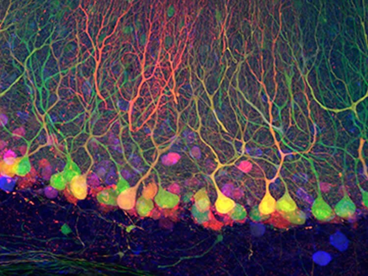 This image shows GFP-expressing Purkinje cells.