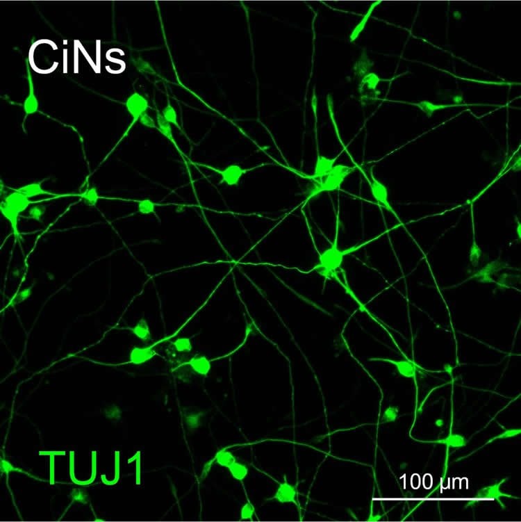 These are neurons induced from mouse stem cells.