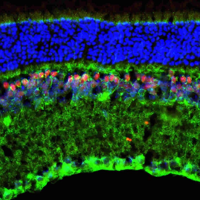 The image shows a mouse retina.
