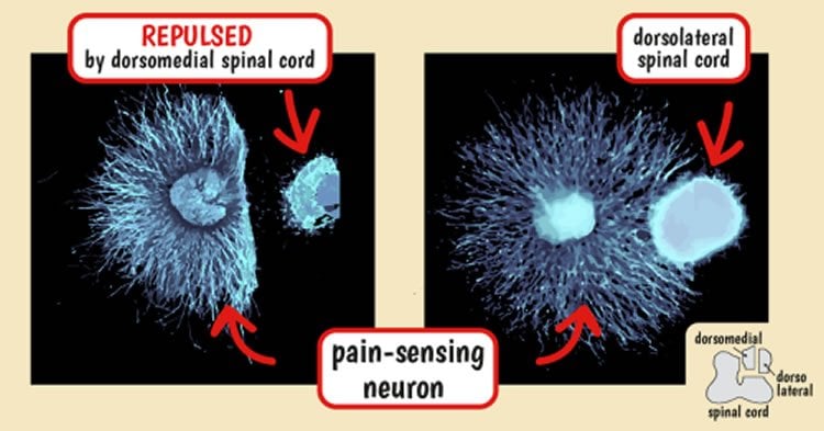 This shows Nociceptive (pain-sensing) neurons.