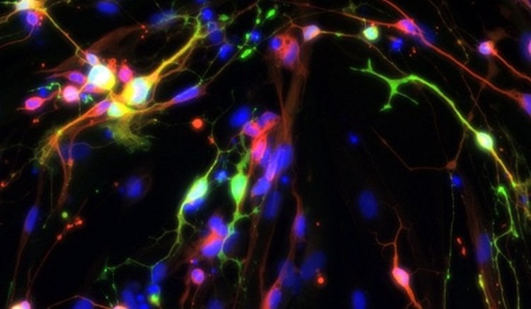 This shows the human serotonin neurons.