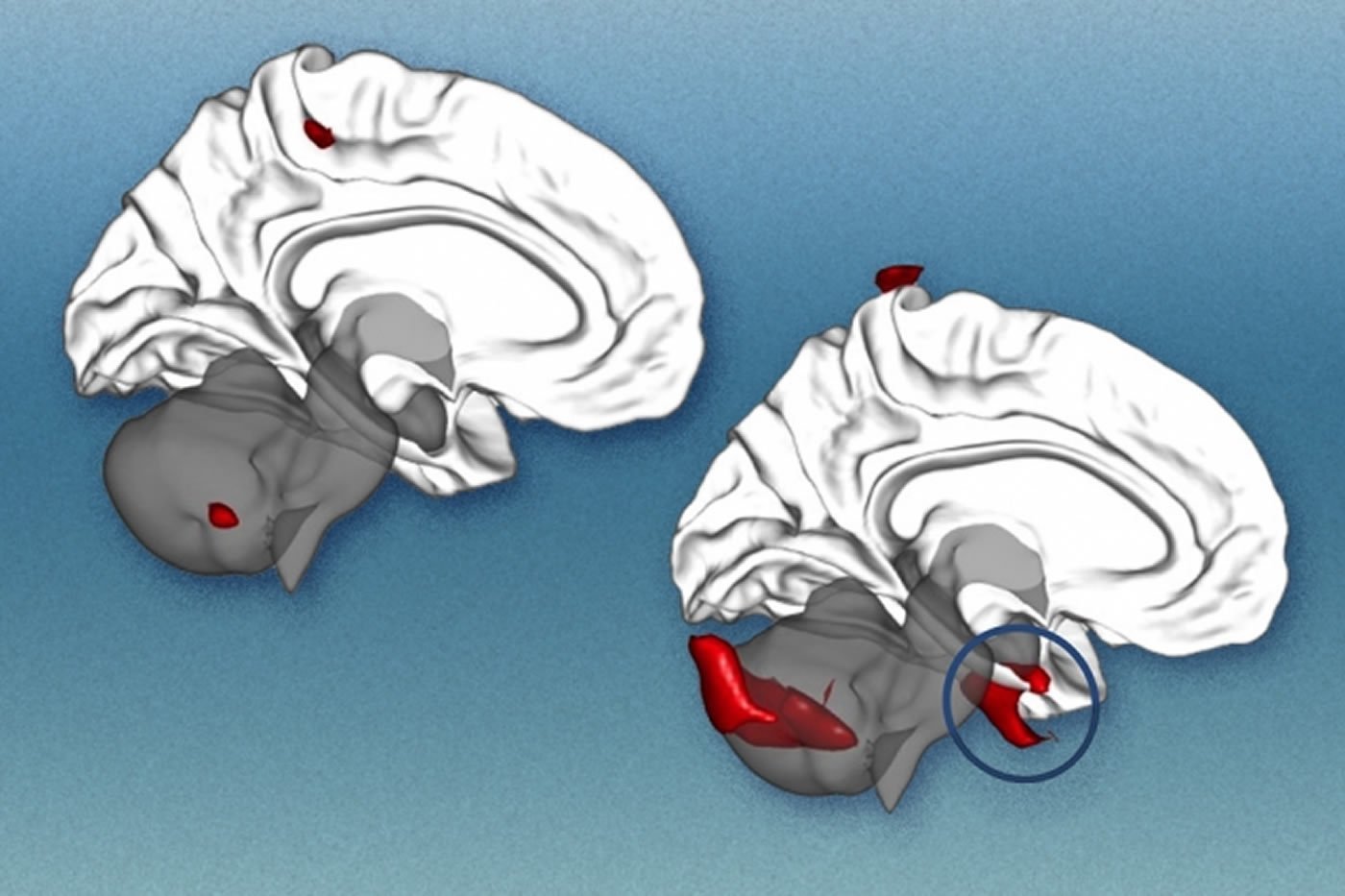 This image shows two brains.
