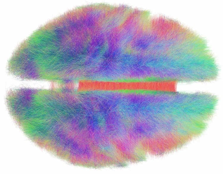 This image shows anatomical fibers that constitute the white matter architecture of the human brain.