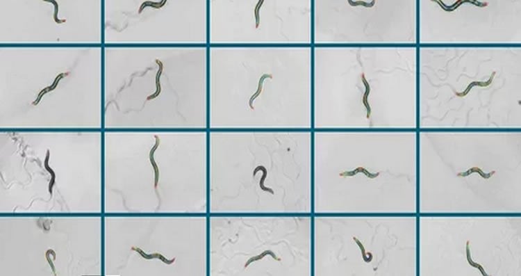 This shows nematode worms in different positions.