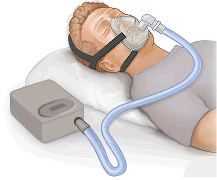 Drawing of a man using a CPAP machine.