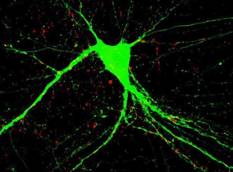 Image of a cultured neuron with an added BDNF protein.