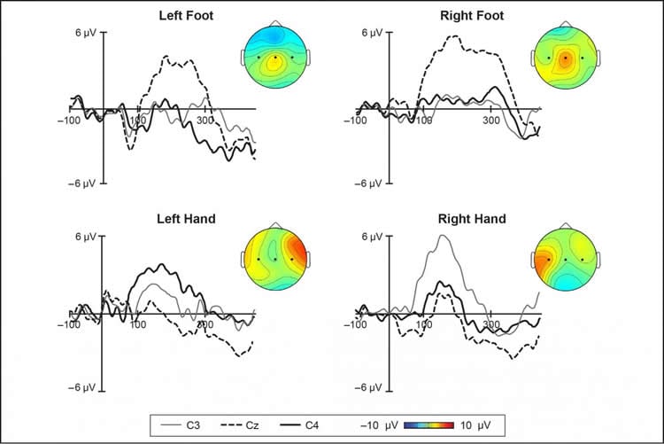 Graph shows different patterns of activity in the infant brain. The caption best describes the image.