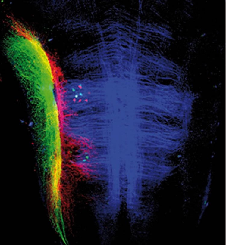 This shows two nerves (stained in red and green), which are responsible for transmitting information from the hair cells to the brain and from neurons (small green dots) that alter hair cell sensitivity.