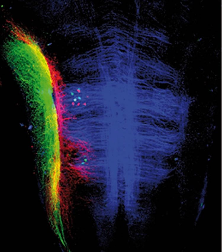 This shows two nerves (stained in red and green), which are responsible for transmitting information from the hair cells to the brain and from neurons (small green dots) that alter hair cell sensitivity.