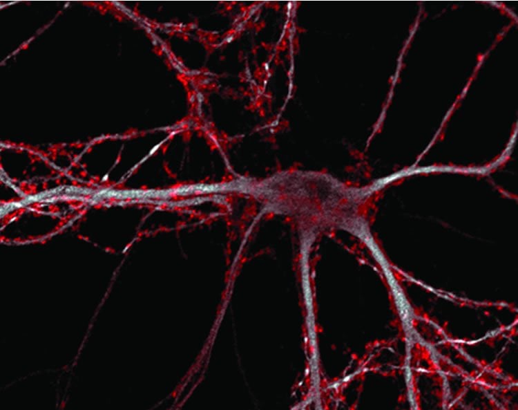 Image of a hippocampal neuron.