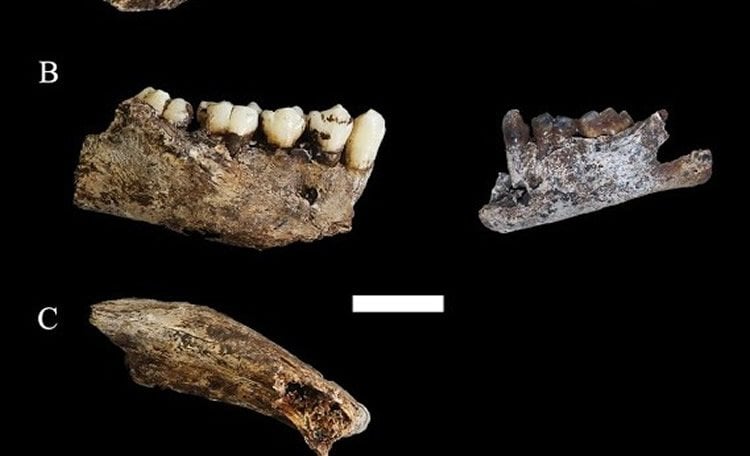 Image of teeth and bone fragments.