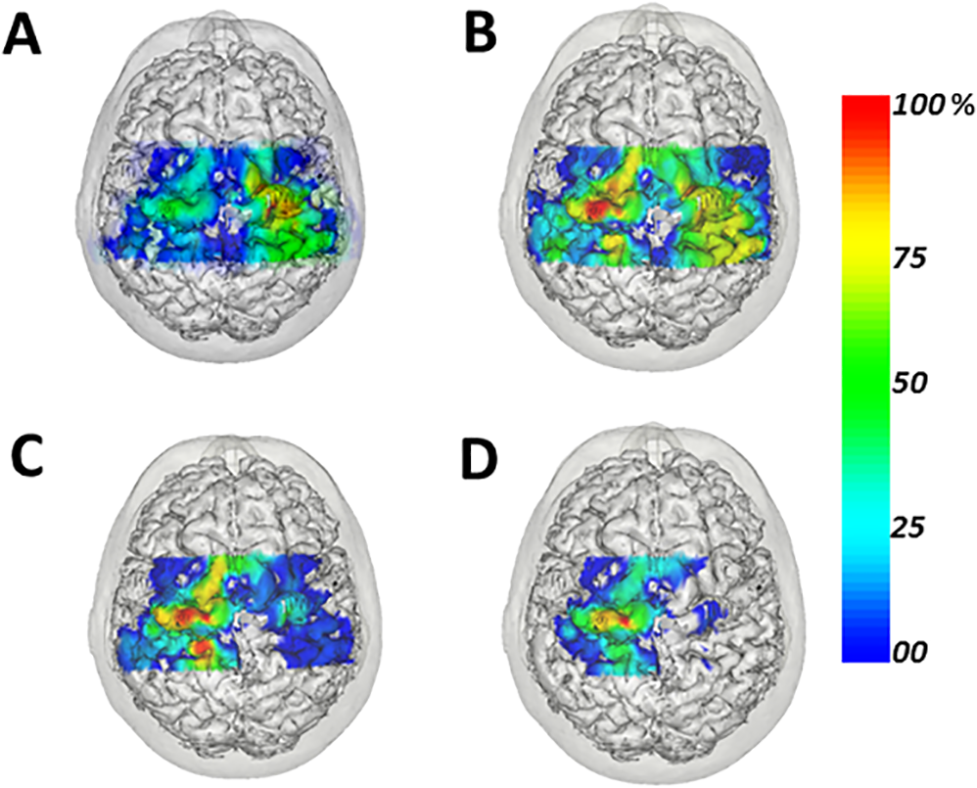 This shows MRI scans where the brain plasticity has taken place.