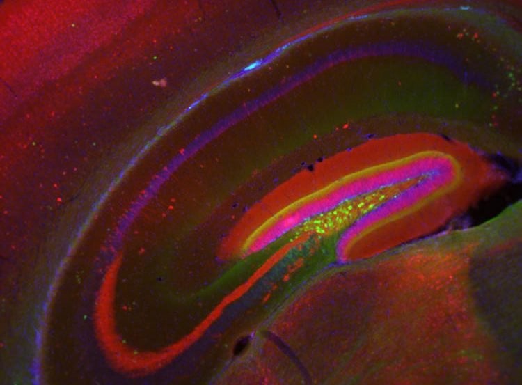 Image of a stained hippcampal slice from a mouse.