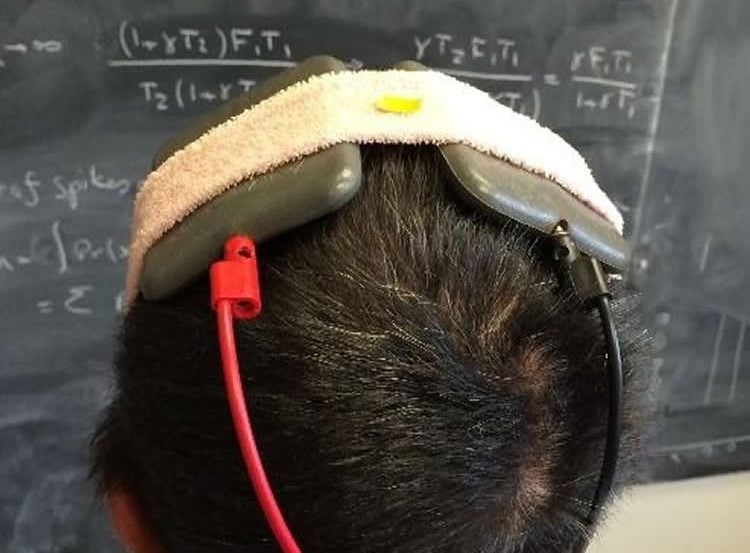 This image shows a person wearing the device.