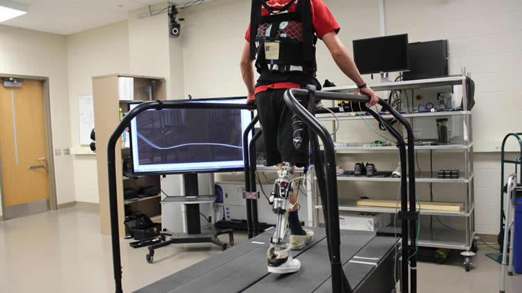 Image shows a person with a prosthetic leg on a treadmill.