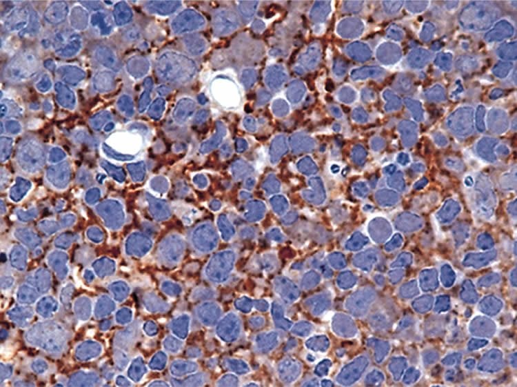 Image shows scrapie prions in intracellular tissue.