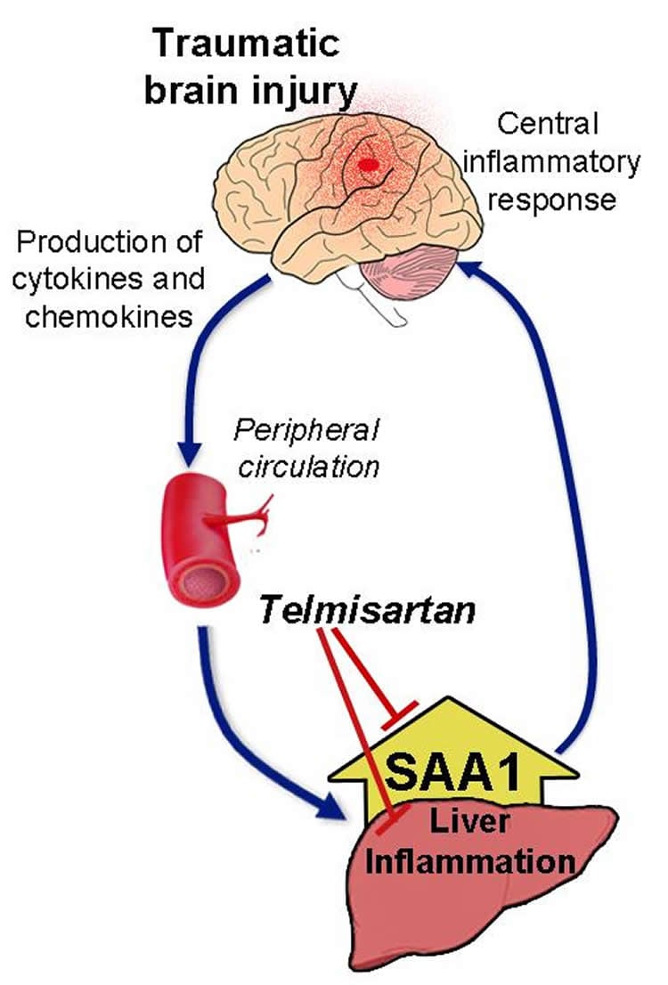 Diagram shows how the brain affects the liver following TBI.