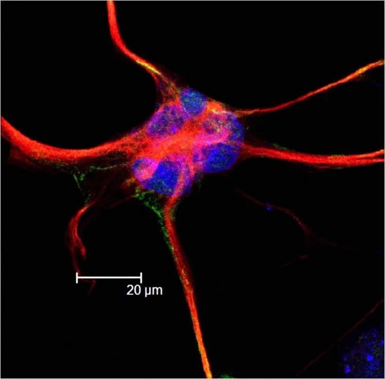 Image shows aa astrocyte.