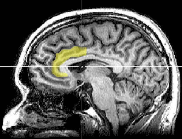 Image shows a brain scan with the anterior cingulate cortex highlighted in yellow.