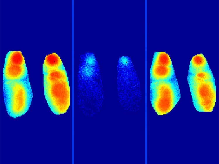 Illustration of a slow brain waves.