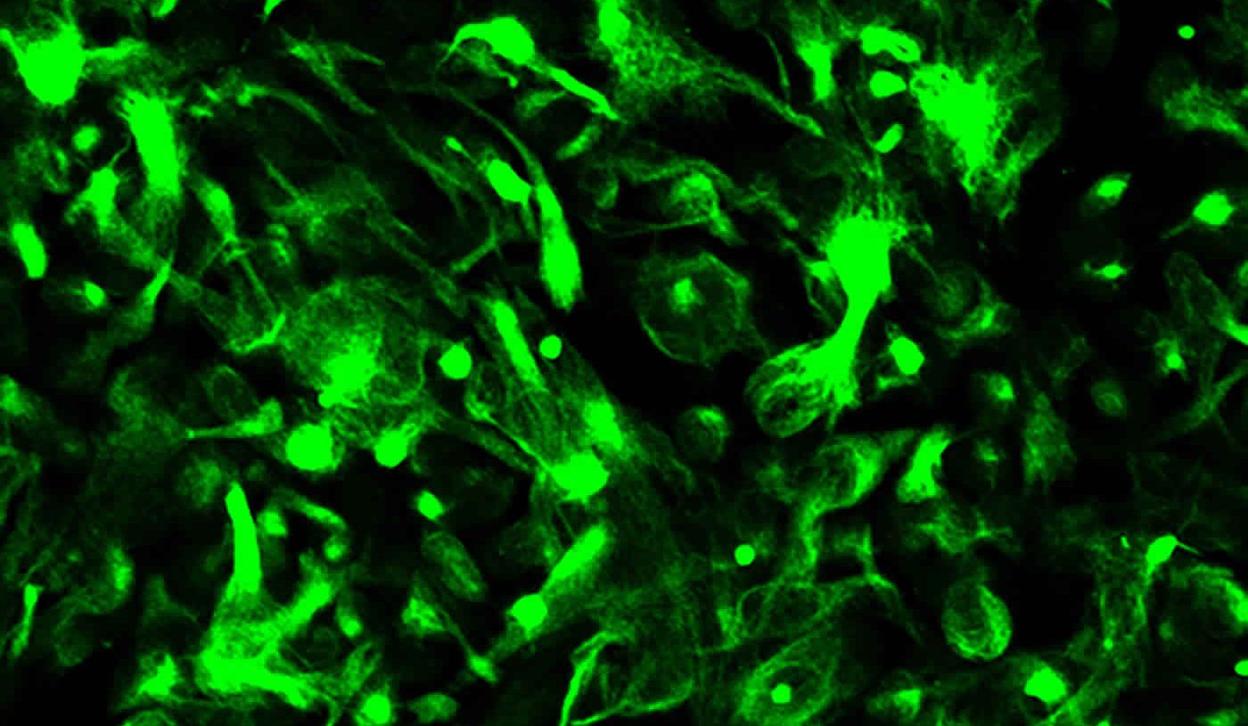 Image shows astroglial cells.