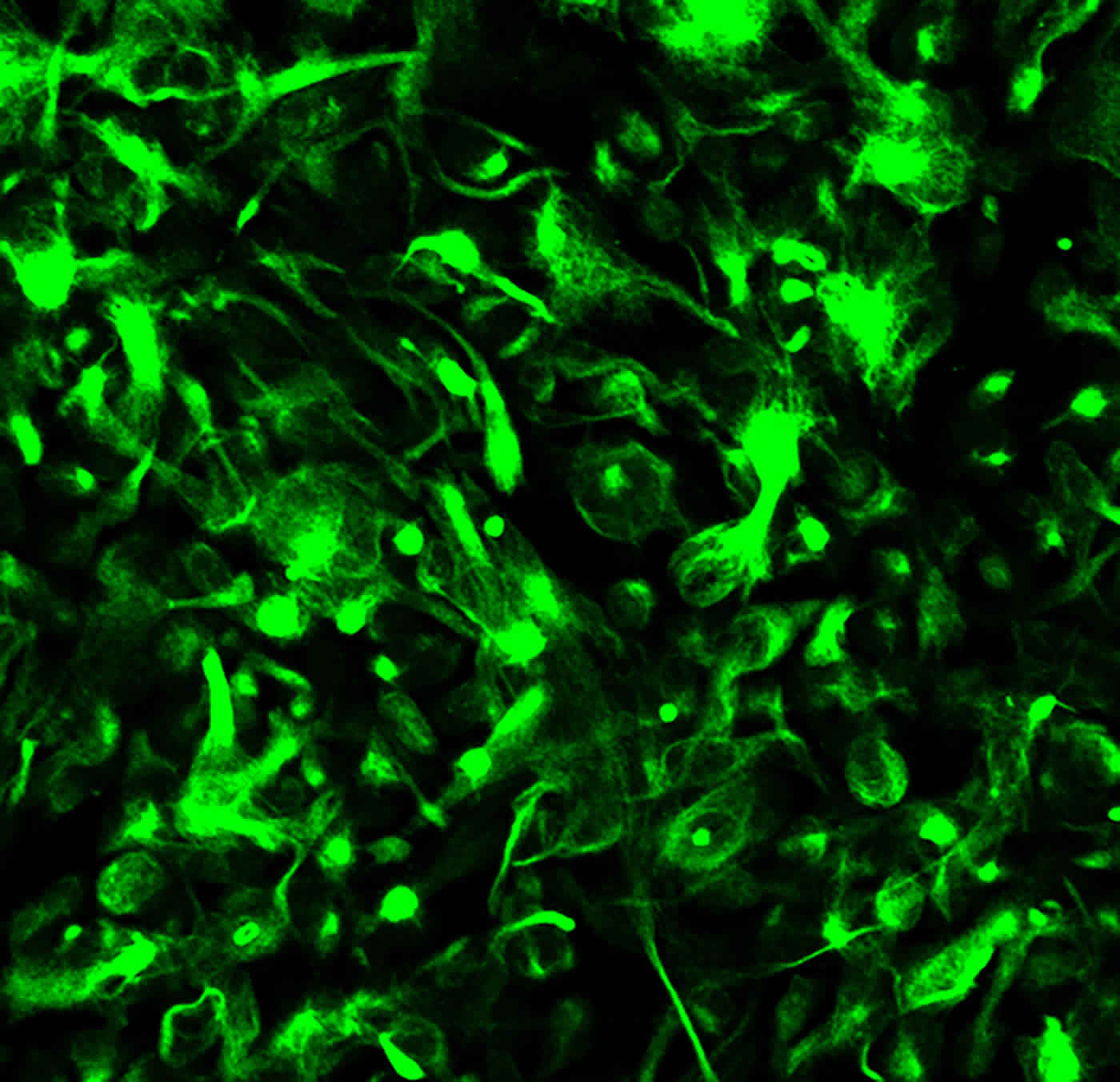 Image shows astroglial cells.