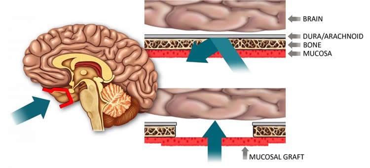 Illustration of a brain.