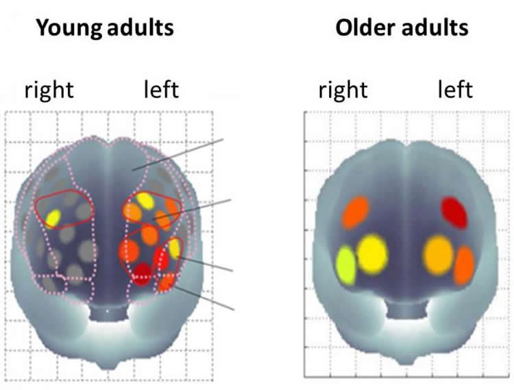 Image of brain scans from the study.
