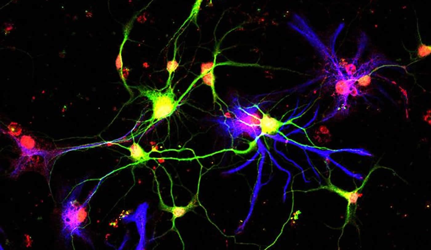 Image shows neurons producing GDF10.