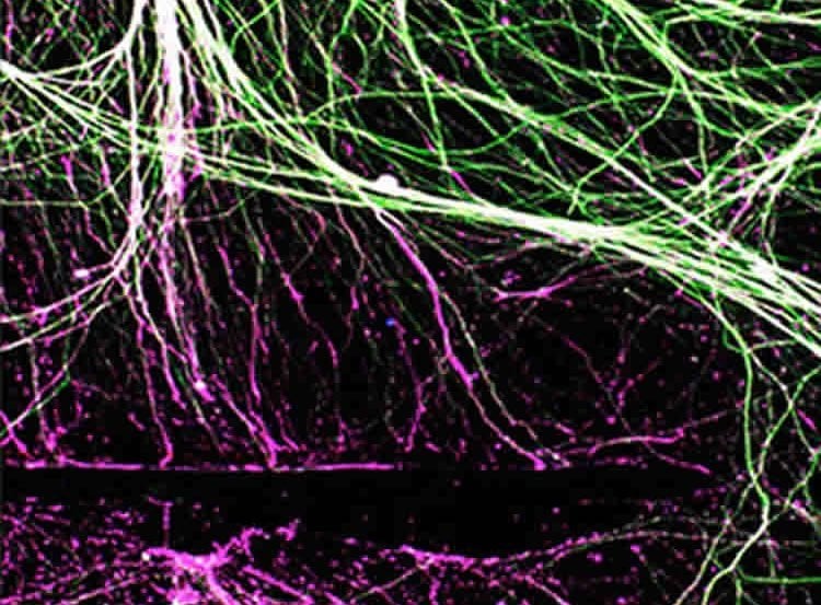 Image of regenerated nerves.