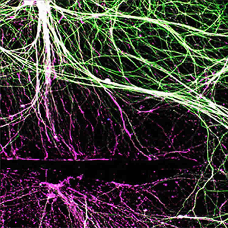 Image of regenerated nerves.
