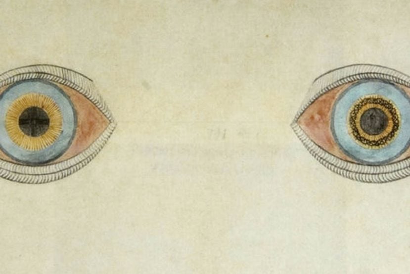 Image shows a drawing of two eyes with different colored pupils.