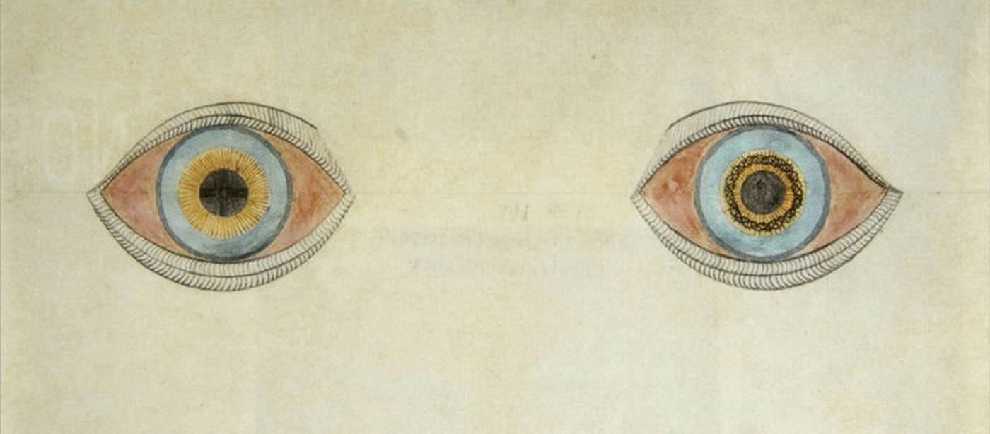 Image shows a drawing of two eyes with different colored pupils.