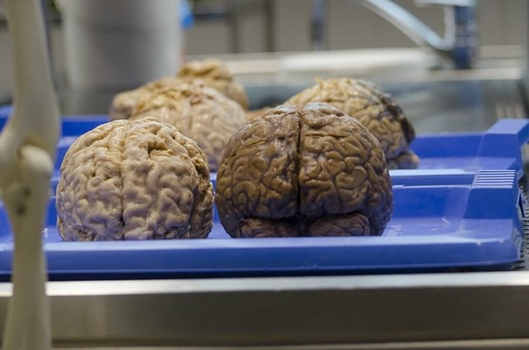 Image shows brains on a tray.