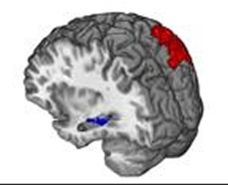 Image of a brain with the hippocampus and parietal lobe highlighted.