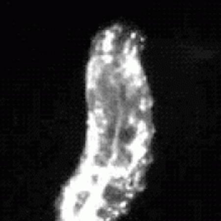 Image shows a larvae.