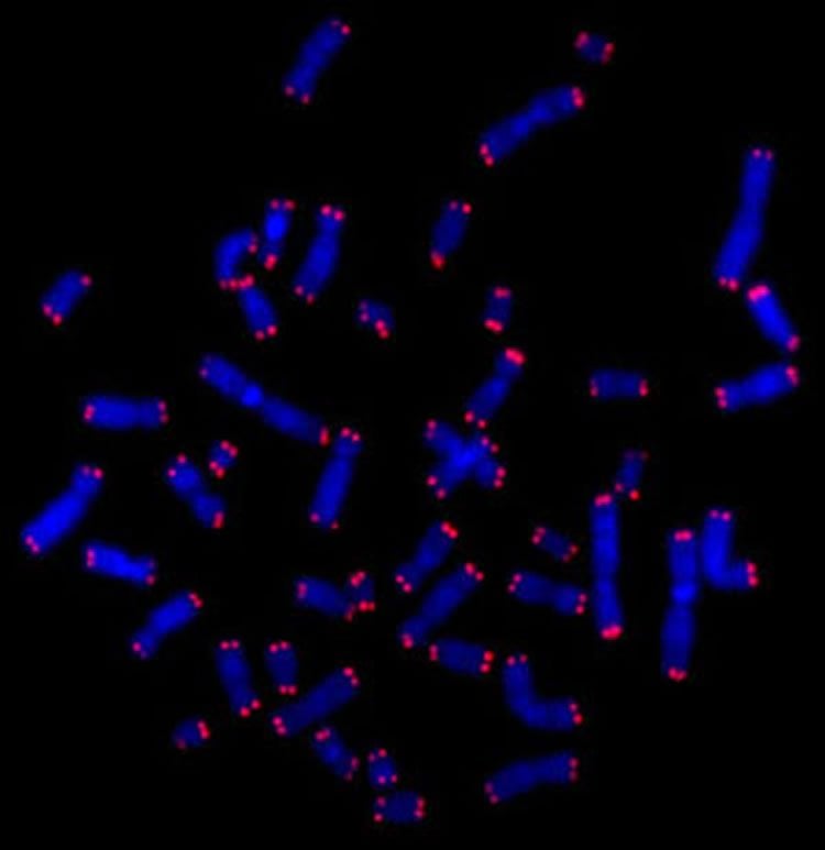 Image shows telomeres.