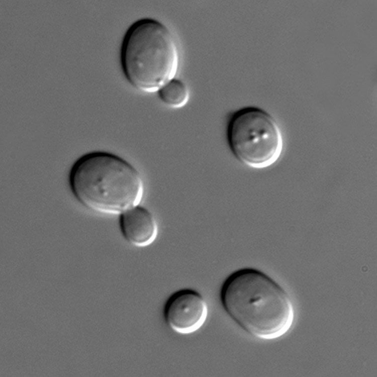 Image shows yeast cells.