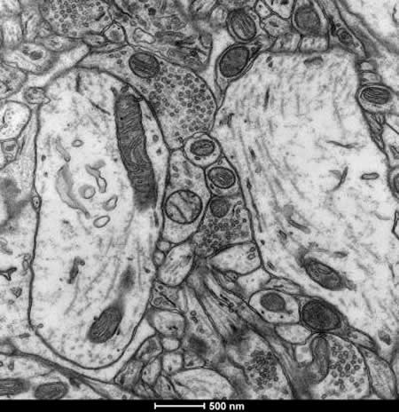 This image shows a brain slice taken from a rat's nucleus accumbens.