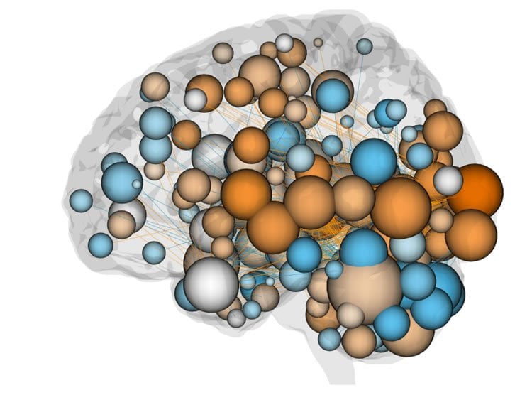 Illustration of a brain with spheres and lines to represent neural networks.