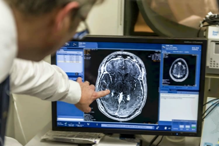Image shows a researcher looking at a brain scan.