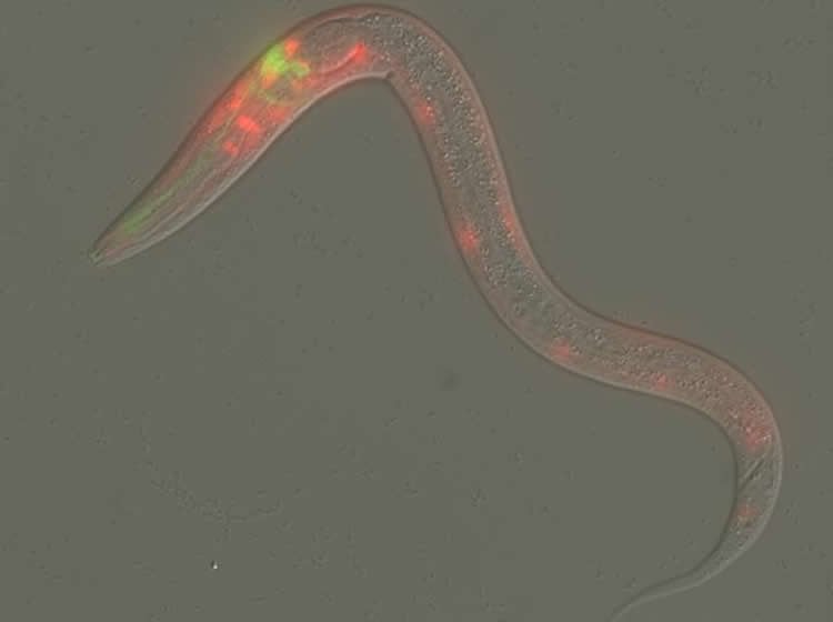 Image shows a C.elegans.
