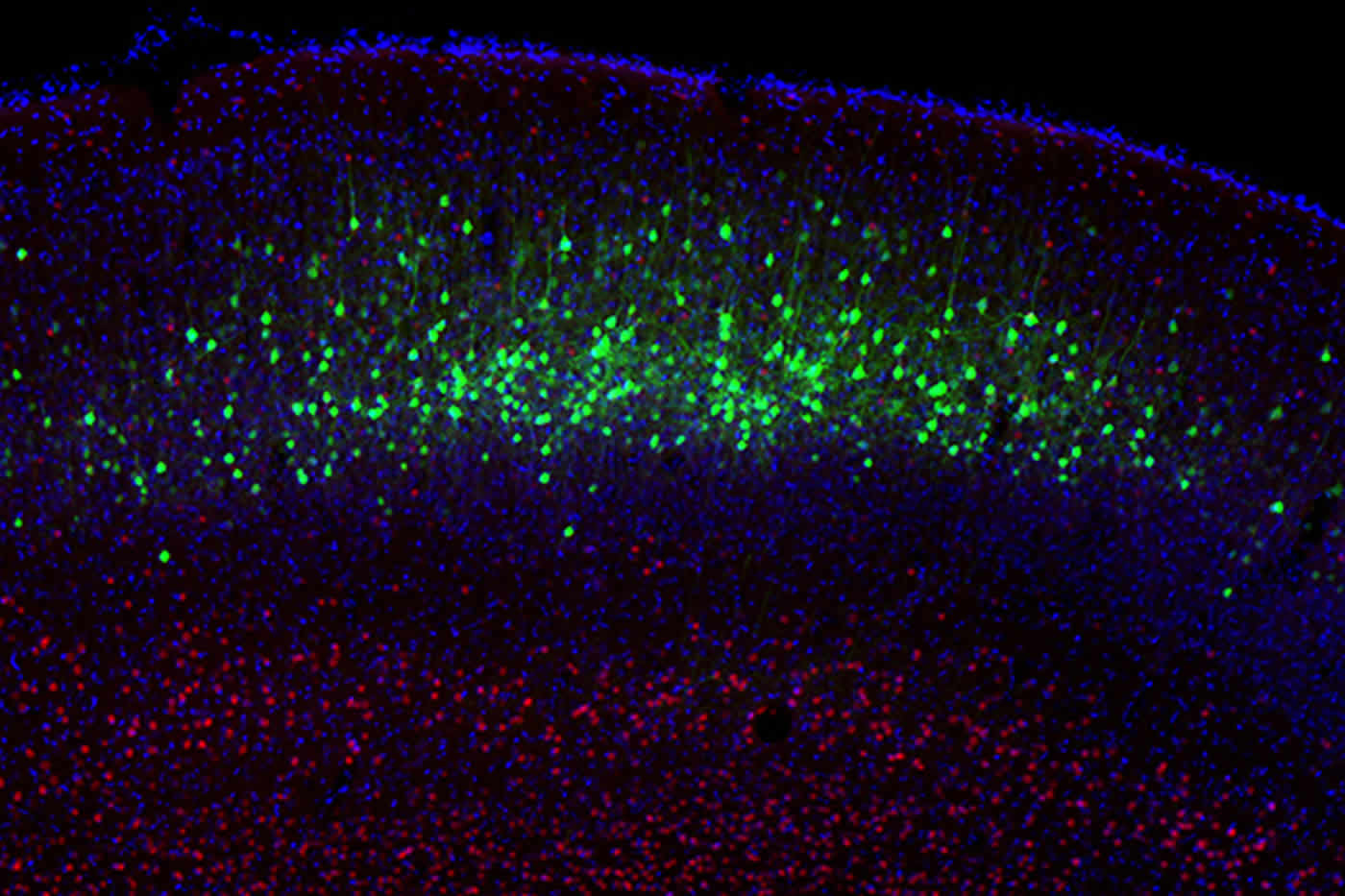 Image shows neurons in the cerebral cortex.