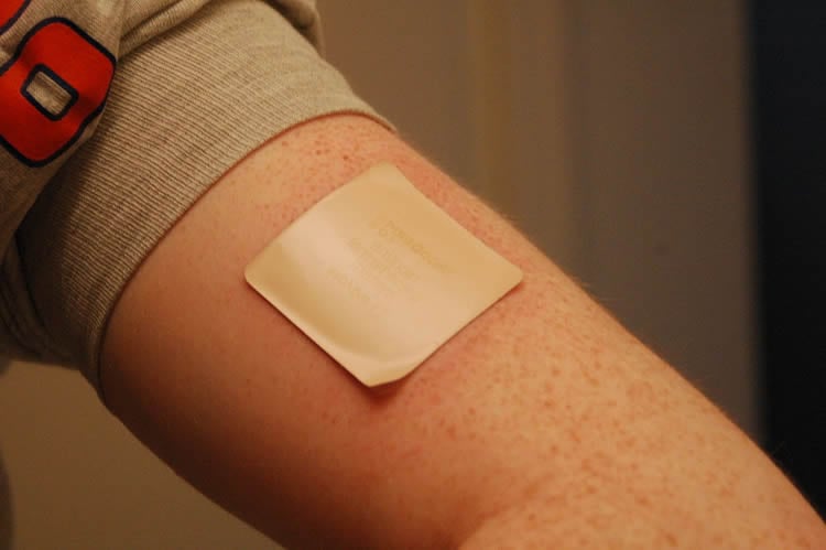 Image shows a nicotine patch on a person's arm.