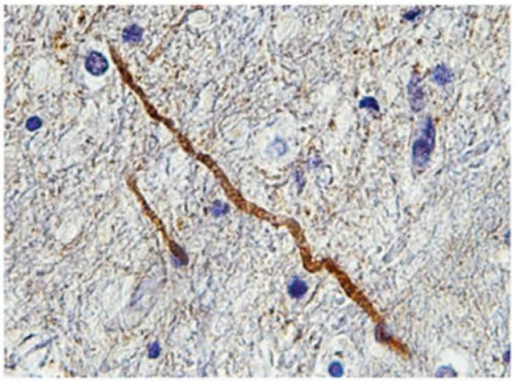 Image shows SNTF stained axons.