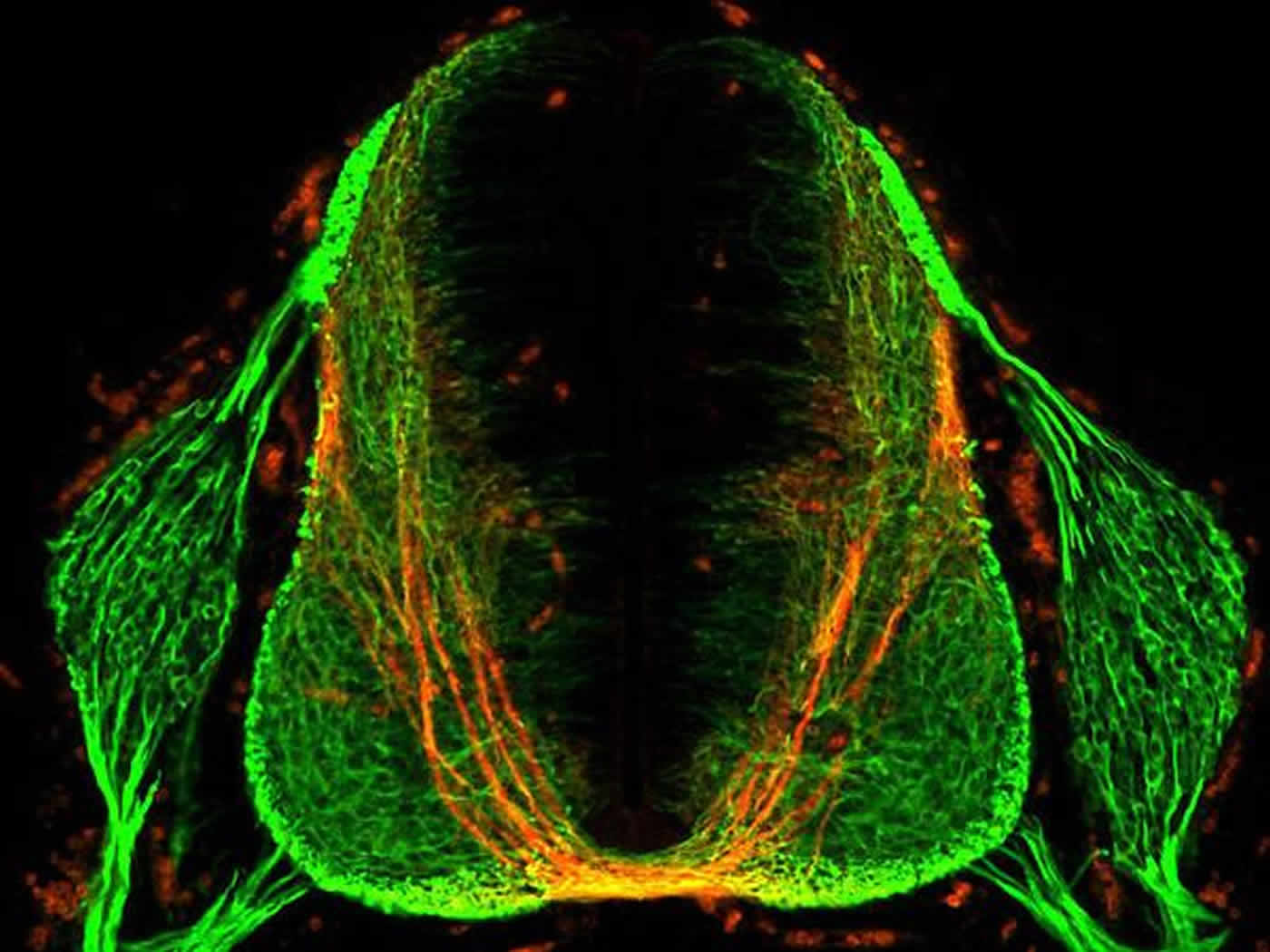 Image shows a section of a mouse spinal cord.